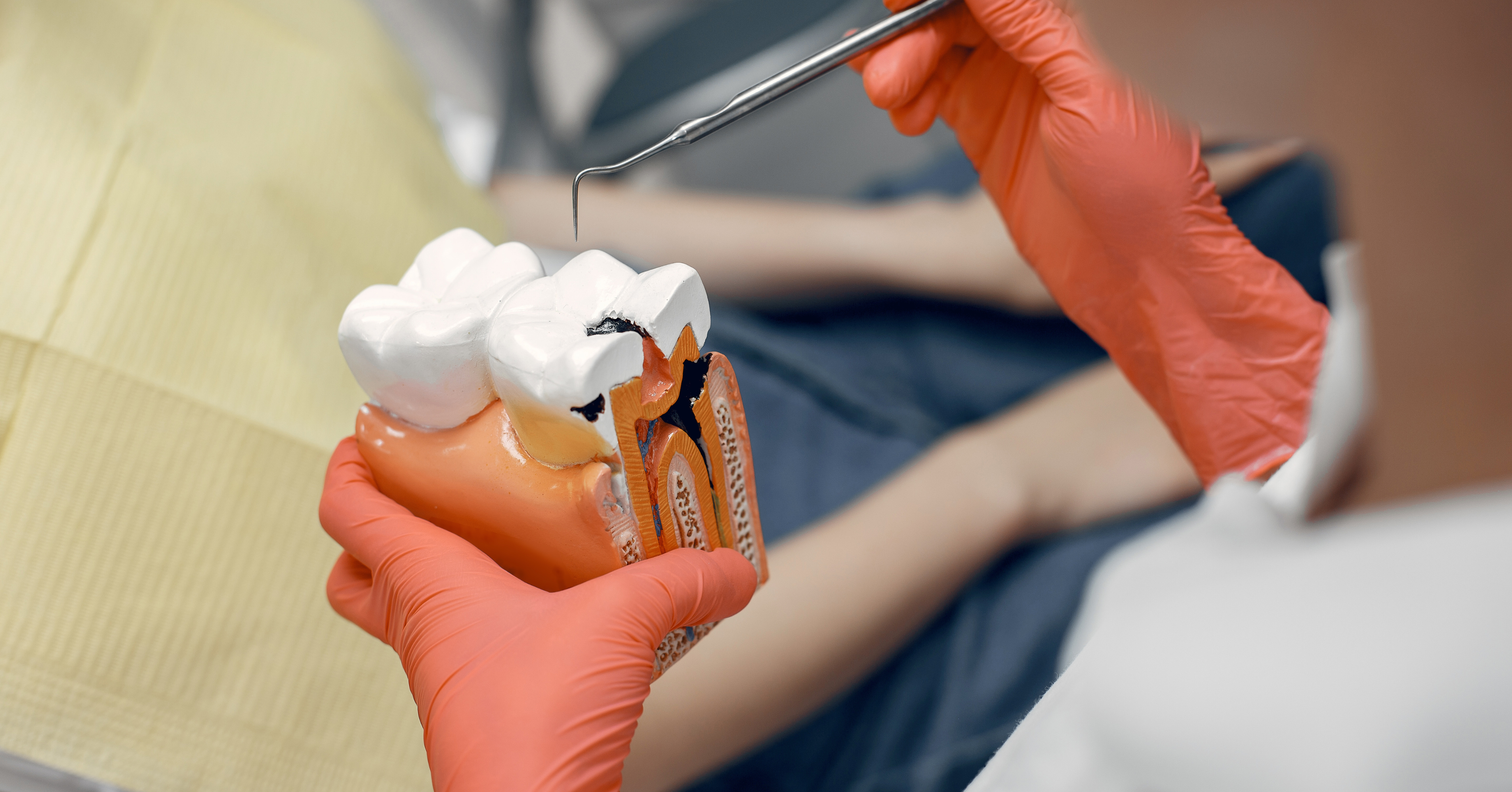 5 facts you need to know about teeth whitening