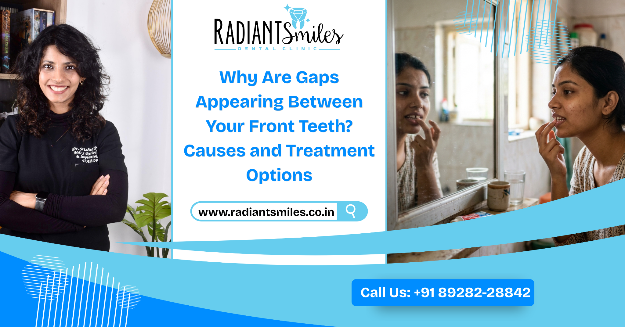 Why Are Gaps Appearing Between Your Front Teeth? Causes and Treatment Options