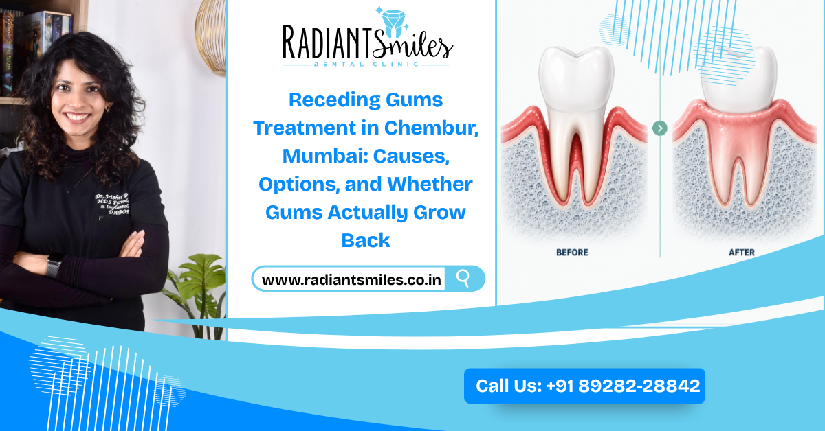 Receding Gums Treatment in Chembur, Mumbai: Causes, Options, and Whether Gums Actually Grow Back