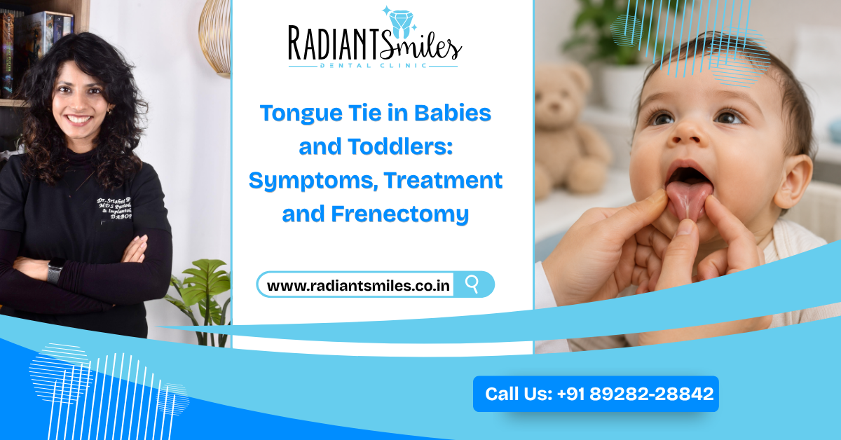Tongue Tie in Babies and Toddlers: Symptoms, Treatment and Frenectomy