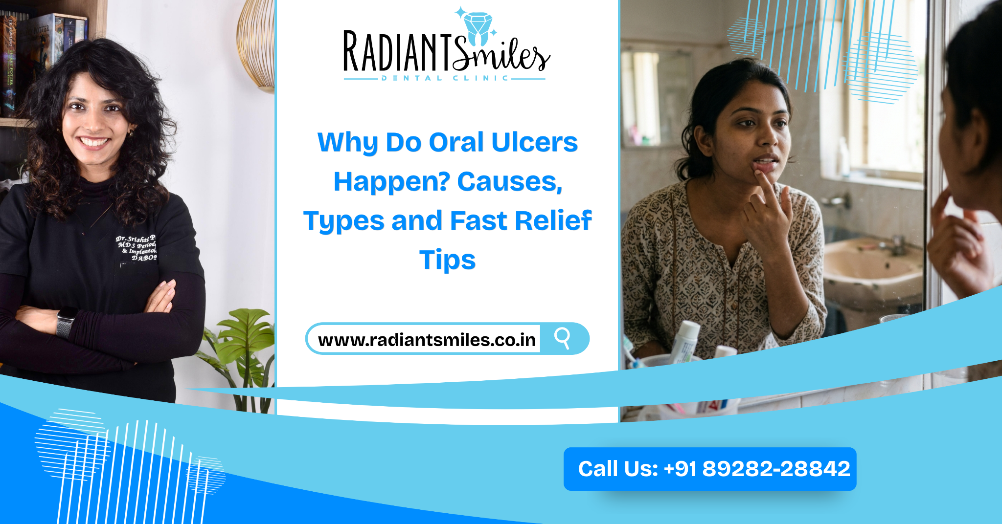 Why Do Oral Ulcers Happen? Causes, Types and Fast Relief Tips