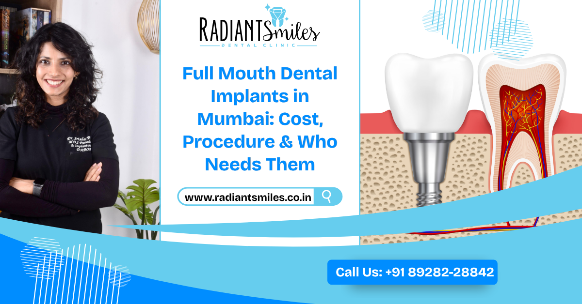 Full Mouth Dental Implants in Mumbai: Cost & Procedure