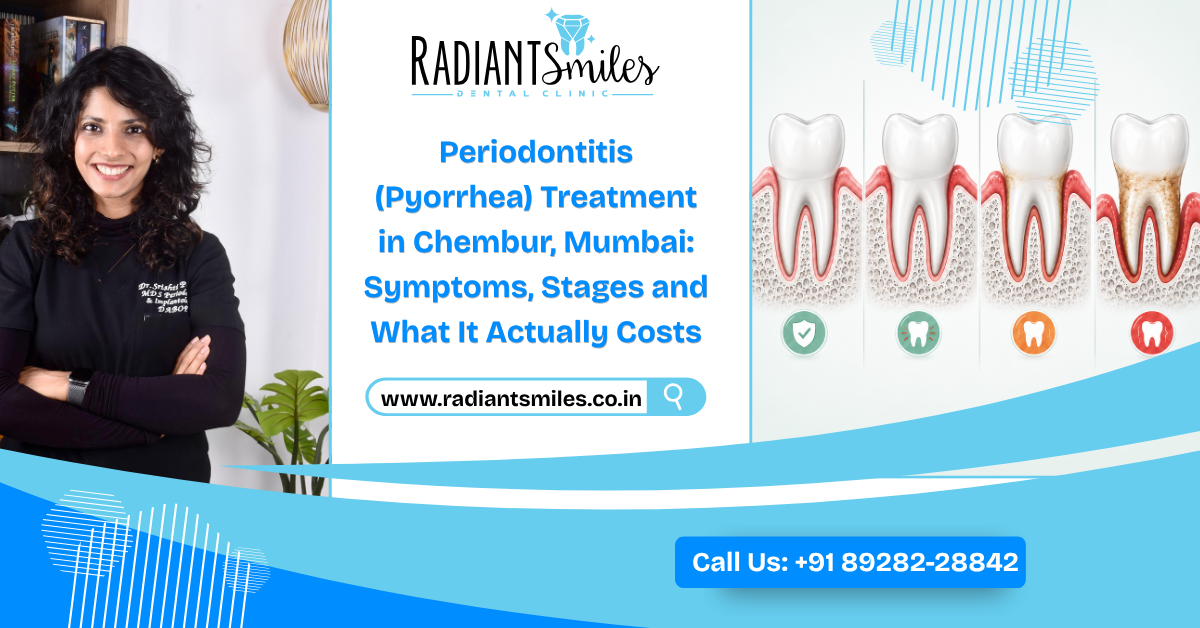 Periodontitis (Pyorrhea) Treatment in Chembur, Mumbai: Symptoms, Stages and What It Actually Costs