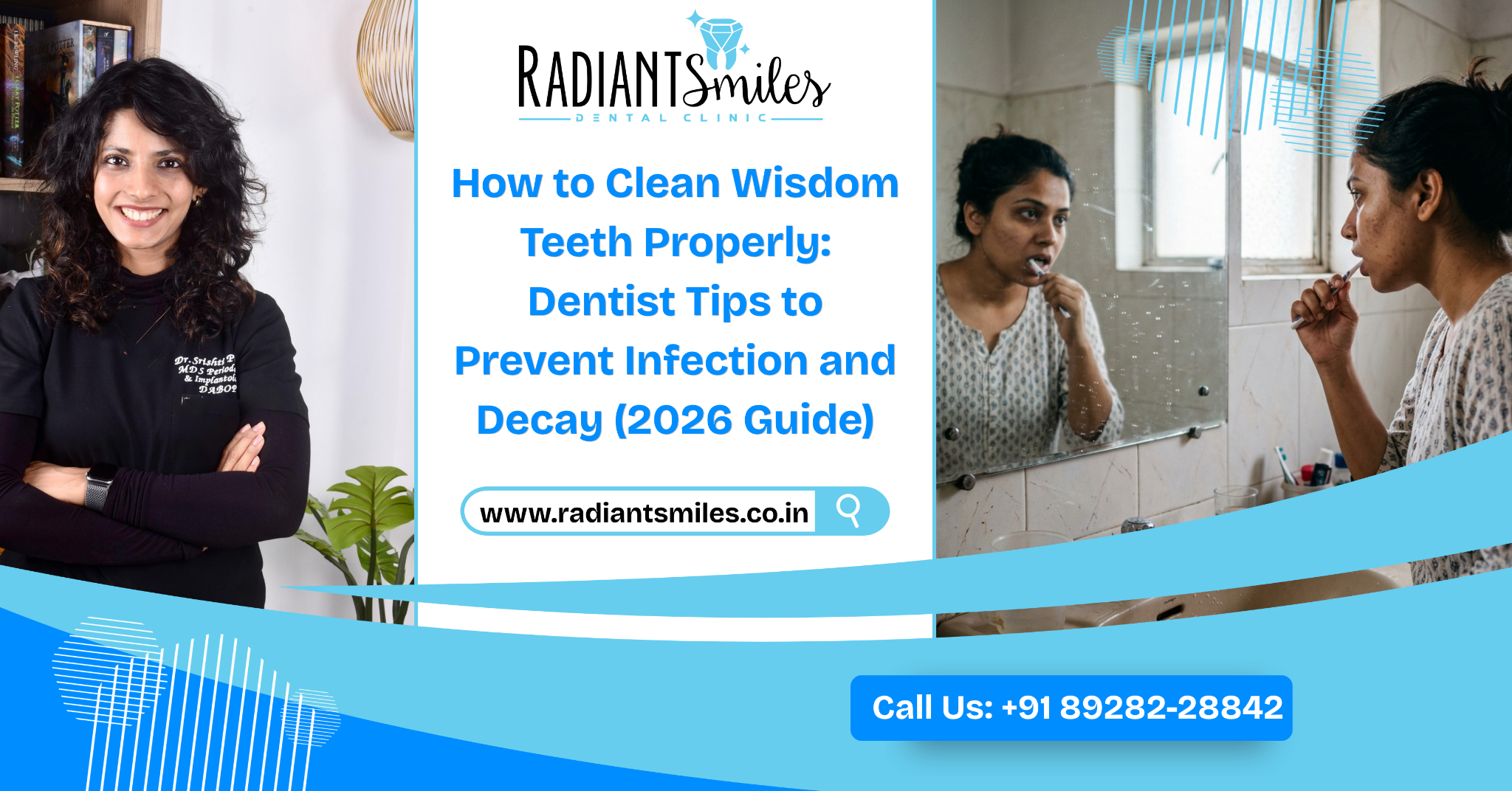 How to Clean Wisdom Teeth Properly: Dentist Tips to Prevent Infection and Decay (2026 Guide)